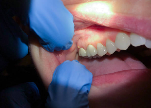 Best Broken or Chipped Tooth Repair in Muleshoe, TX
